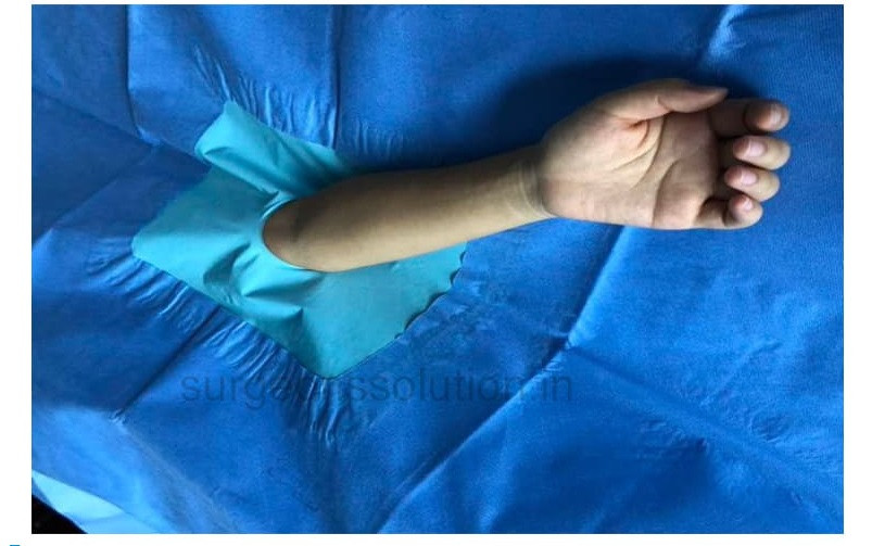 Elbow O Drape Sterile with Elastic Aperture