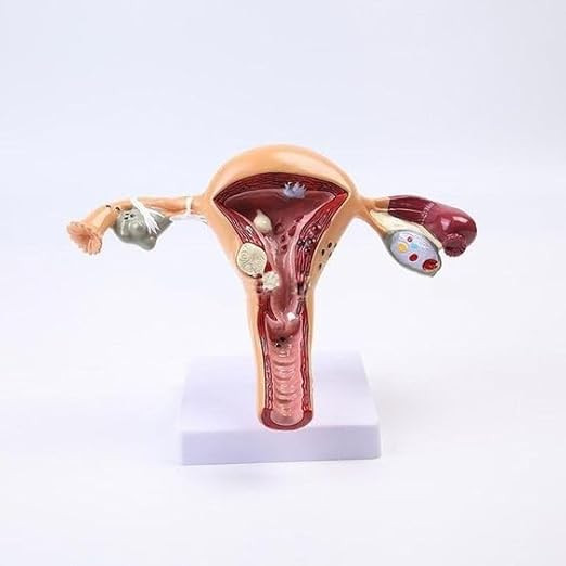 Uterus and Ovary Anatomy Model
